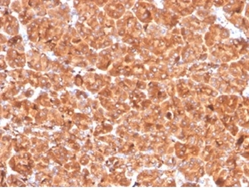 CTSD Antibody