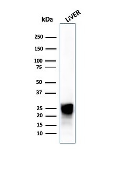 CTSD Antibody