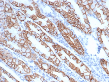 CTNND1 Antibody