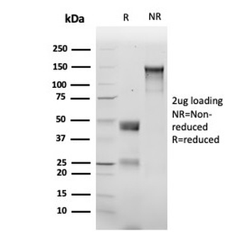 CTNND1 Antibody