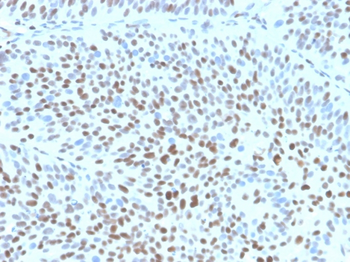 CDKN1B Antibody