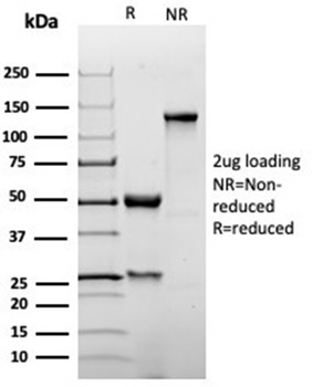 CDKN1B Antibody