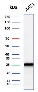 CDKN1B Antibody