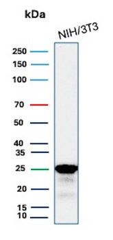 CDKN1B Antibody