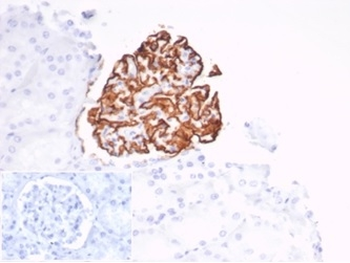 CR1 Antibody