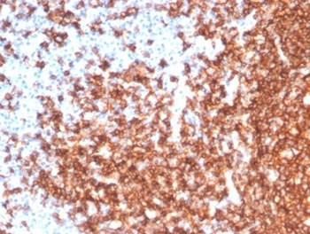 MS4A1 Antibody
