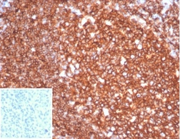 MS4A1 Antibody