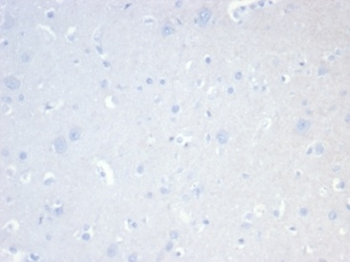 MS4A1 Antibody