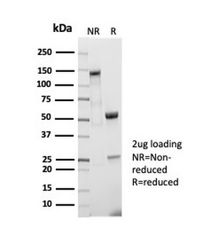 CD5 Antibody
