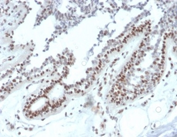 NME1 Antibody