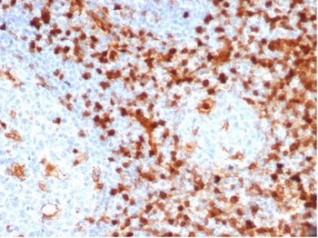 ANXA1 Antibody