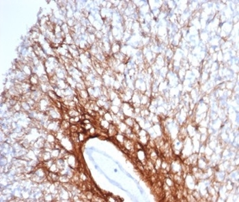 GFAP (Astrocyte & Neural Stem Cell Marker) Antibody