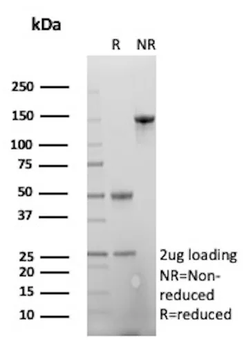 GFAP (Astrocyte & Neural Stem Cell Marker) Antibody