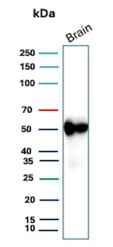 GFAP (Astrocyte & Neural Stem Cell Marker) Antibody