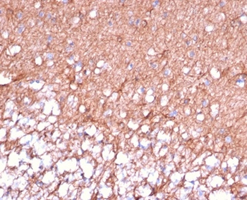 GFAP (Astrocyte & Neural Stem Cell Marker) Antibody