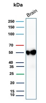 GFAP (Astrocyte & Neural Stem Cell Marker) Antibody