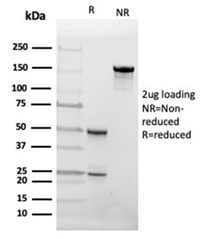 FABP4 Antibody