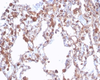 ALDH1A1 Antibody
