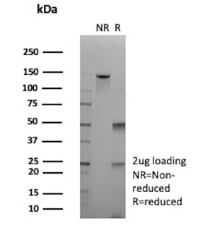 ALDH1A1 Antibody