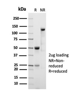 ALDH1A1 Antibody