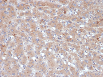 SERPINA3 Antibody