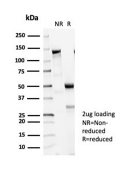 Recombinant Tubulin beta 3 / TUBB3 (Neuronal & Stem Cell Marker) Antibody