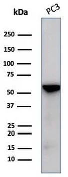 Recombinant Tubulin beta 3 / TUBB3 (Neuronal & Stem Cell Marker) Antibody