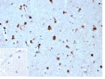 CDKN1B Antibody