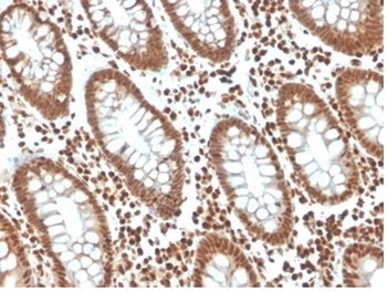 CDKN1B Antibody