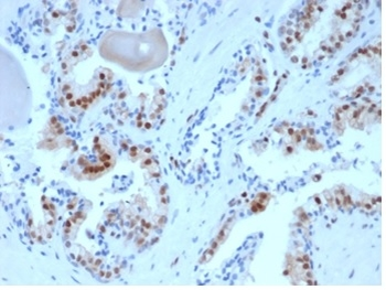 CDKN1B Antibody