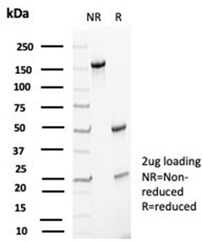 CDKN1B Antibody
