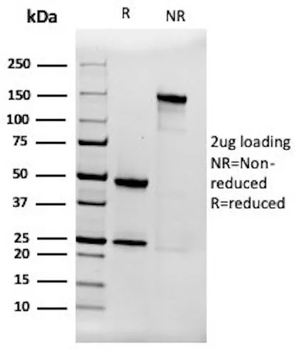 A2M Antibody