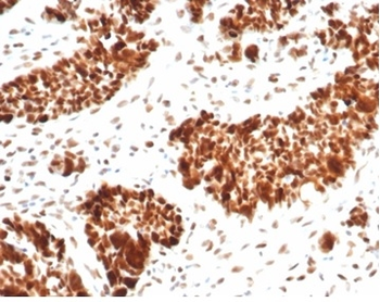 MSH6 Antibody