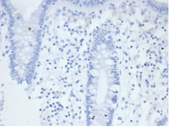 Alkaline Phosphatase (Placental) / PLAP (Germ Cell Tumor Marker) Antibody
