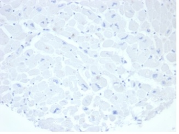 Alkaline Phosphatase (Placental) / PLAP (Germ Cell Tumor Marker) Antibody