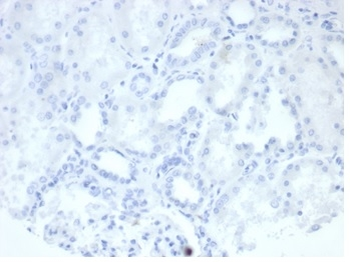 Alkaline Phosphatase (Placental) / PLAP (Germ Cell Tumor Marker) Antibody