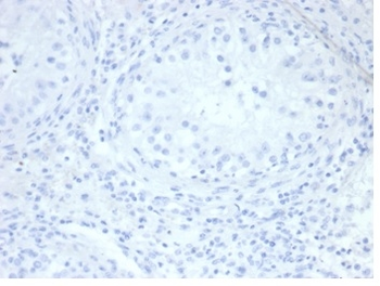 Alkaline Phosphatase (Placental) / PLAP (Germ Cell Tumor Marker) Antibody
