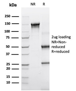 SERPINA3 Antibody