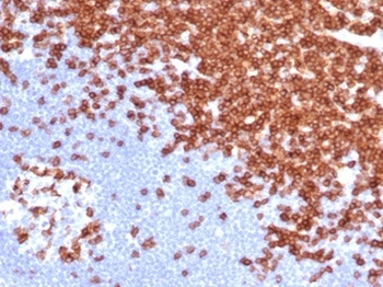 Recombinant CD3e (T-Cell Marker) Antibody