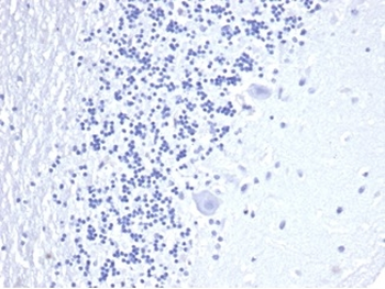 Recombinant CD3e (T-Cell Marker) Antibody
