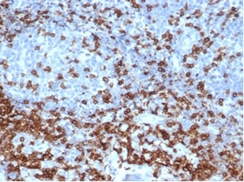 Recombinant CD3e (T-Cell Marker) Antibody