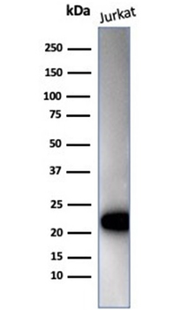 Recombinant CD3e (T-Cell Marker) Antibody