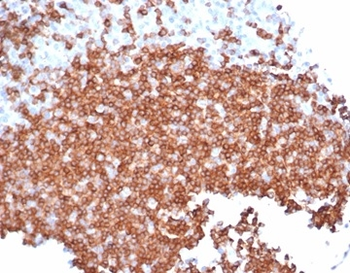 CD22 Antibody