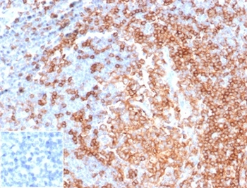 CD22 Antibody