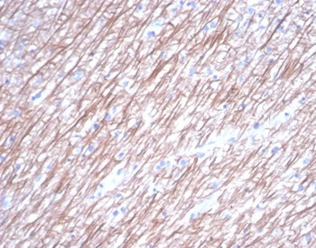 Recombinant Tubulin beta 3 / TUBB3 (Neuronal & Stem Cell Marker) Antibody