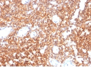 MS4A1 Antibody