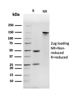 NME1 Antibody
