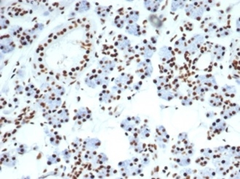 NCL Antibody