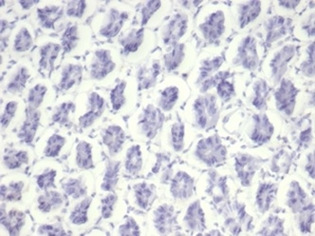 NCL Antibody