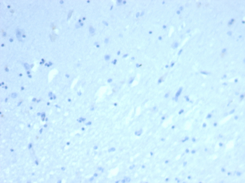 Recombinant ERG (Vascular Endothelial & Prostate Marker) Antibody